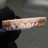 Diamond Set Solid Cap & Window Grillz | Grillz Melbourne Australia