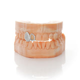 Diamond Set Solid Cap & Window Grillz | Grillz Melbourne Australia