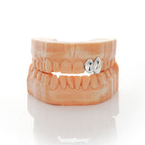 2 Piece Solid Cap Grillz | Grillz Melbourne Australia