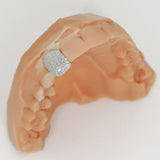 Single Cap Micro Pavé Diamond Grill | Grillz Melbourne Australia