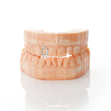 1 Piece Window Open Face Grillz | Grillz Melbourne Australia