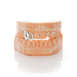 2 Piece Solid Cap & Window Grillz | Grillz Melbourne Australia