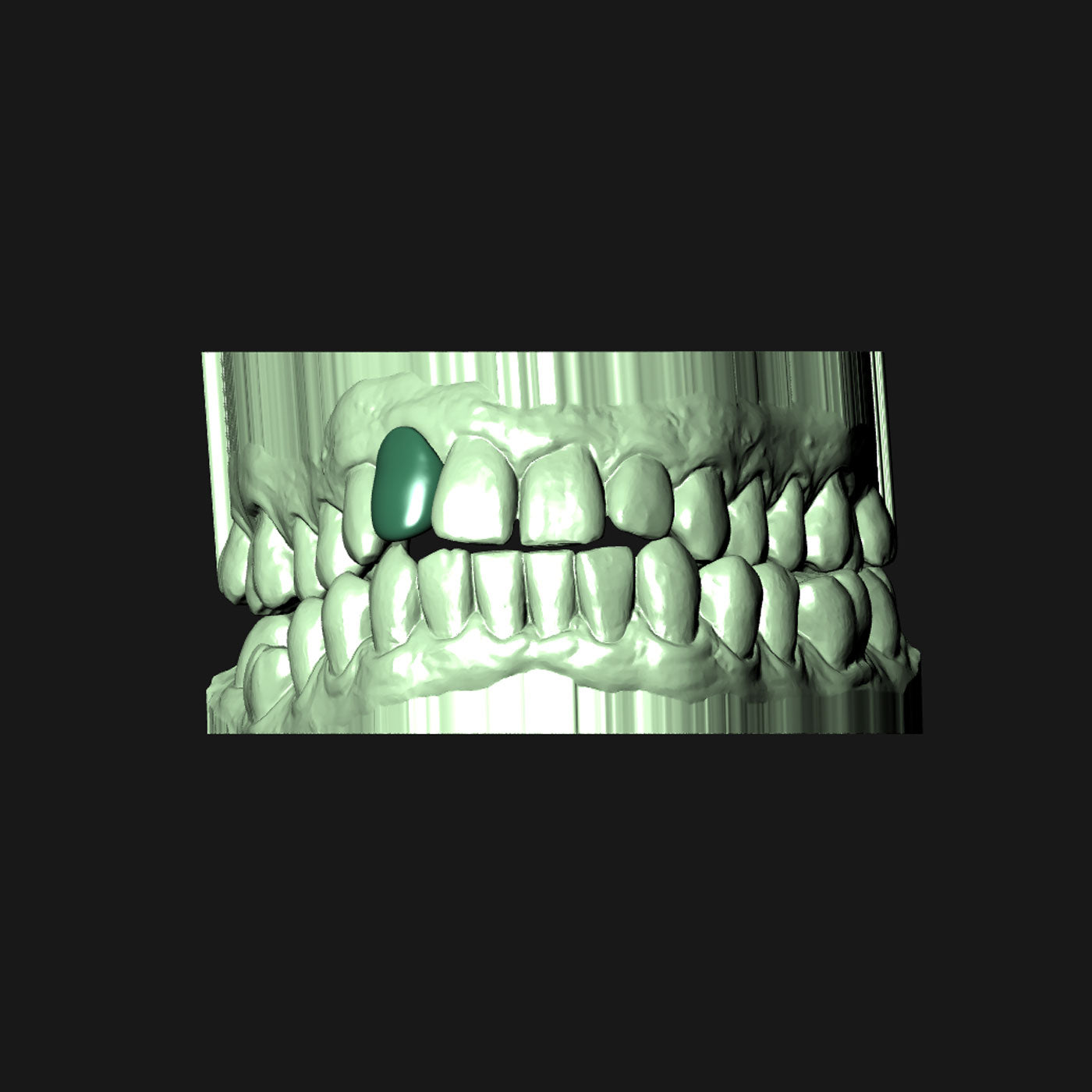 1 Piece Extended Solid Cap Grillz | Grillz Melbourne Australia
