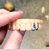 2 Piece Solid Cap Grillz | Grillz Melbourne Australia