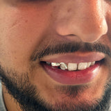 2 Piece Solid Cap & Window Grillz | Grillz Melbourne Australia