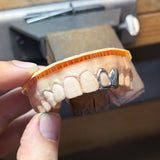 White Gold Grillz