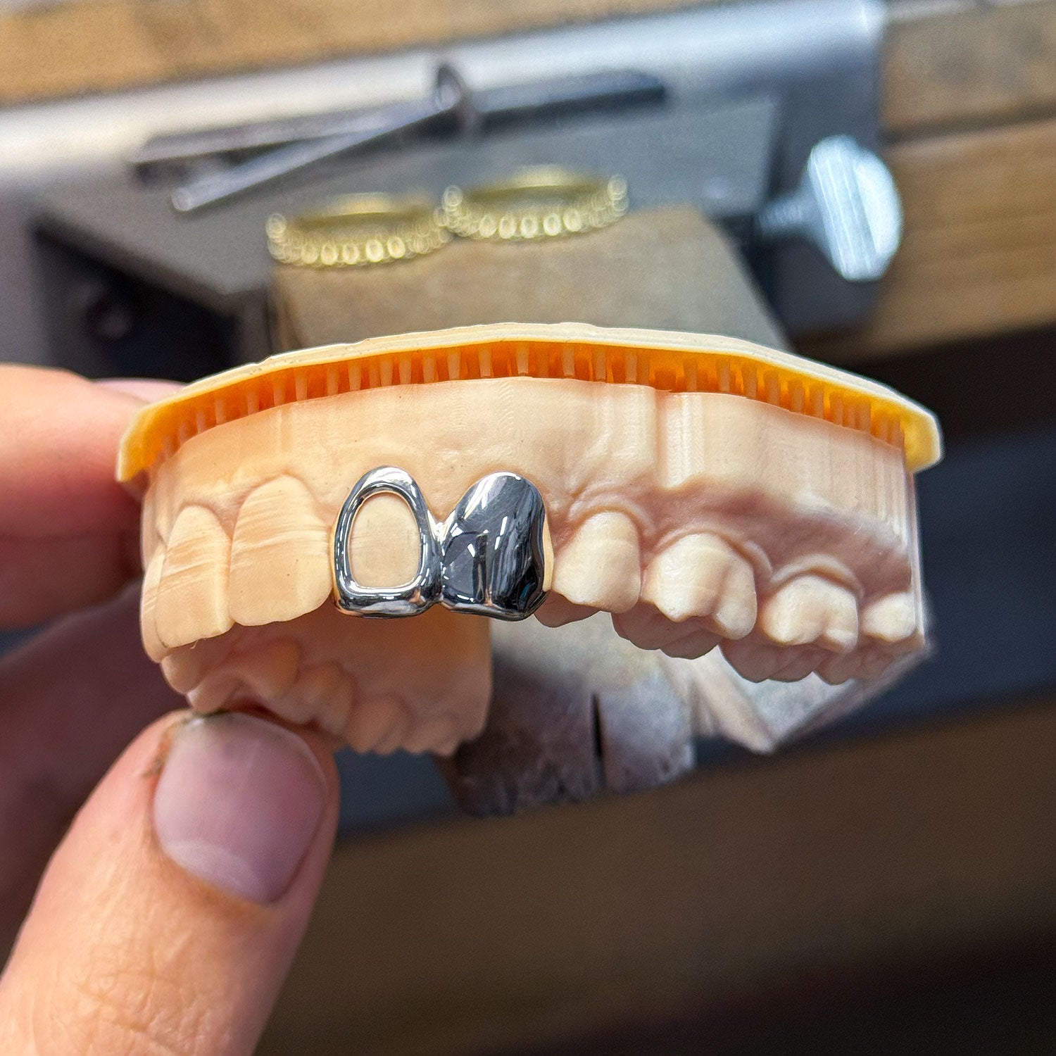 White Gold Grillz