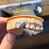 White Gold Grillz