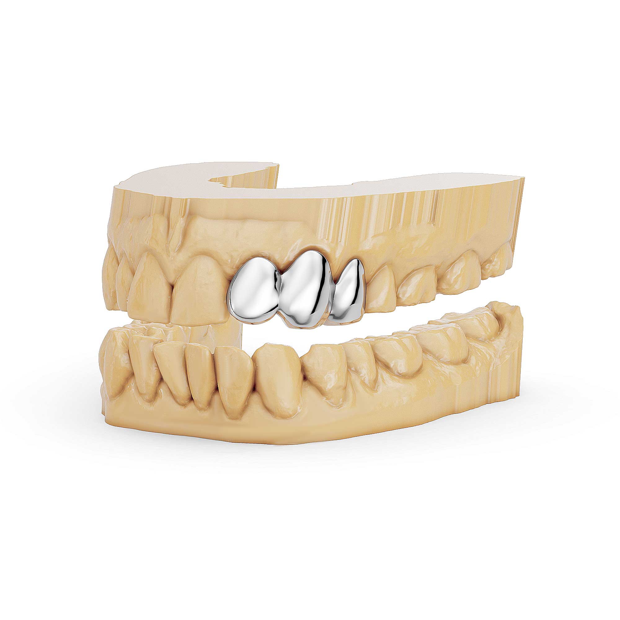 3 Piece Solid Cap Grillz | Grillz Melbourne Australia – side view
