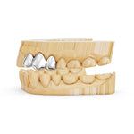 3 Piece Solid Cap Grillz | Grillz Melbourne Australia – side view