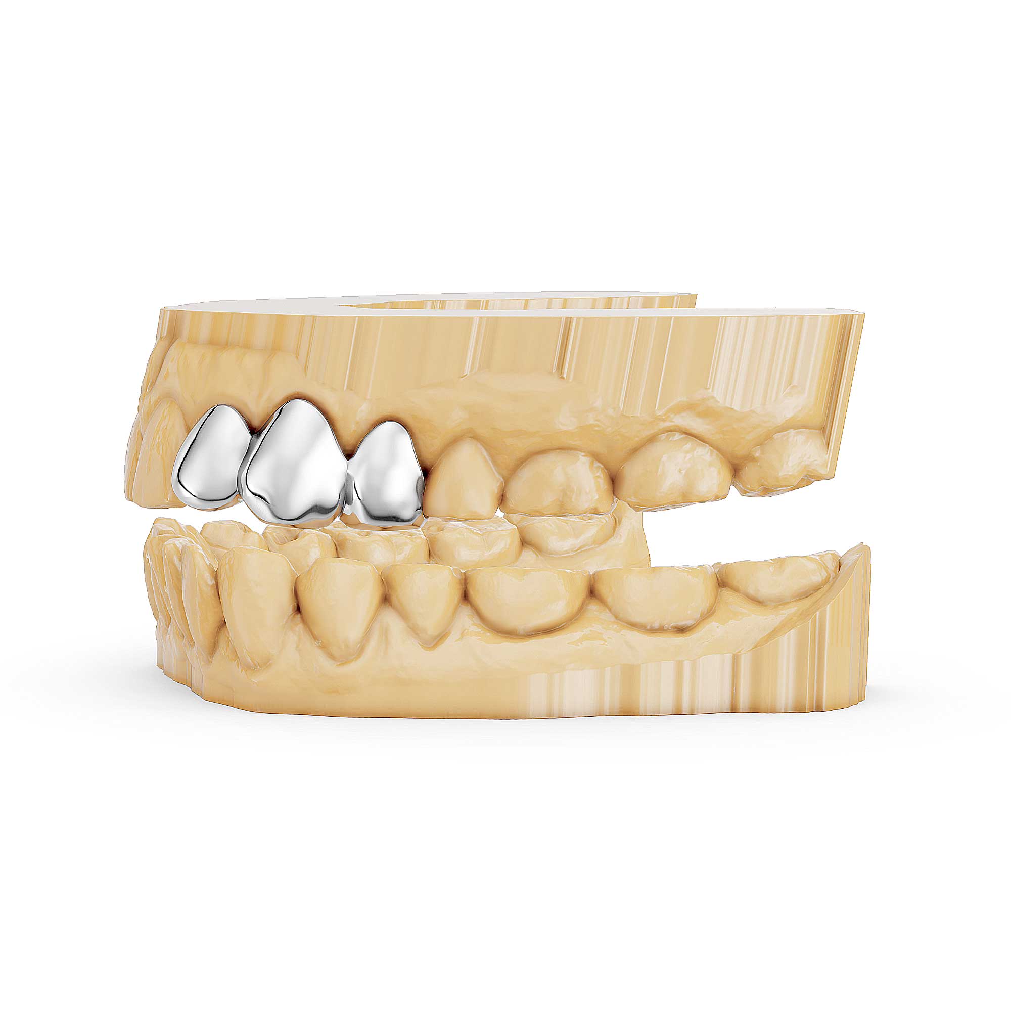 3 Piece Solid Cap Grillz | Grillz Melbourne Australia – side view