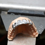 Dental model with metallic braces on a metal surface