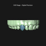 Single Cap Micro Pavé Diamond Grill | Grillz Melbourne Australia