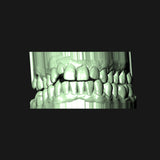 1 Piece Extended Solid Cap Grillz | Grillz Melbourne Australia